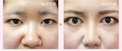 整形で大きく変わりたい 症例写真1
