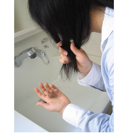 女性の薄毛増毛