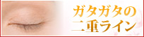ガタガタの二重ライン