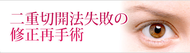 失敗 二重切開法